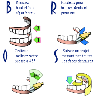 Redresser ses dents à l’âge adulte : méthodes et conseils